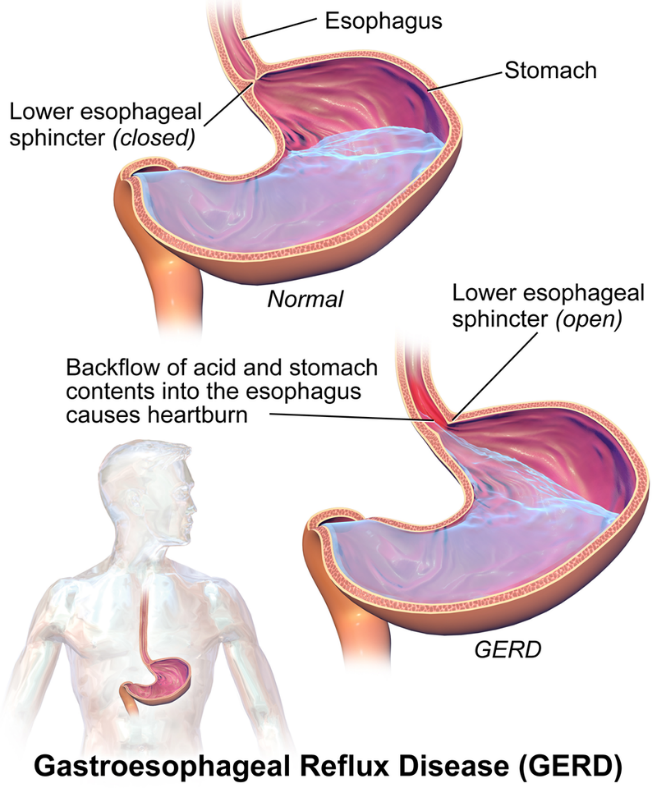 A diagram of the esophagus Description automatically generated